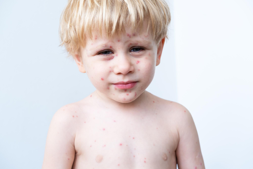 Dermatoscopia digitală pentru copii permite monitorizarea precisă a alunițelor și leziunilor pigmentare, fără durere, cu echipamente moderne dedicate pielii sensibile a celor mici.