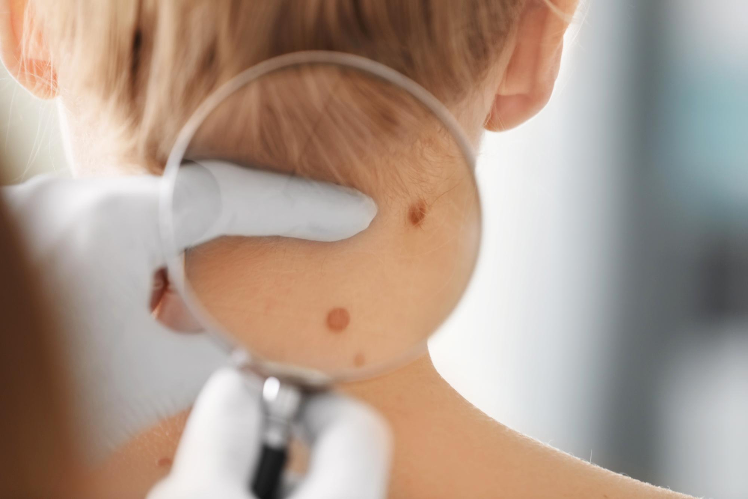 La Dermasan Timișoara, consultația dermatologică pediatrică se desfășoară într-un mediu calm, sigur și prietenos, unde copilul se simte confortabil, iar părintele este informat complet.
